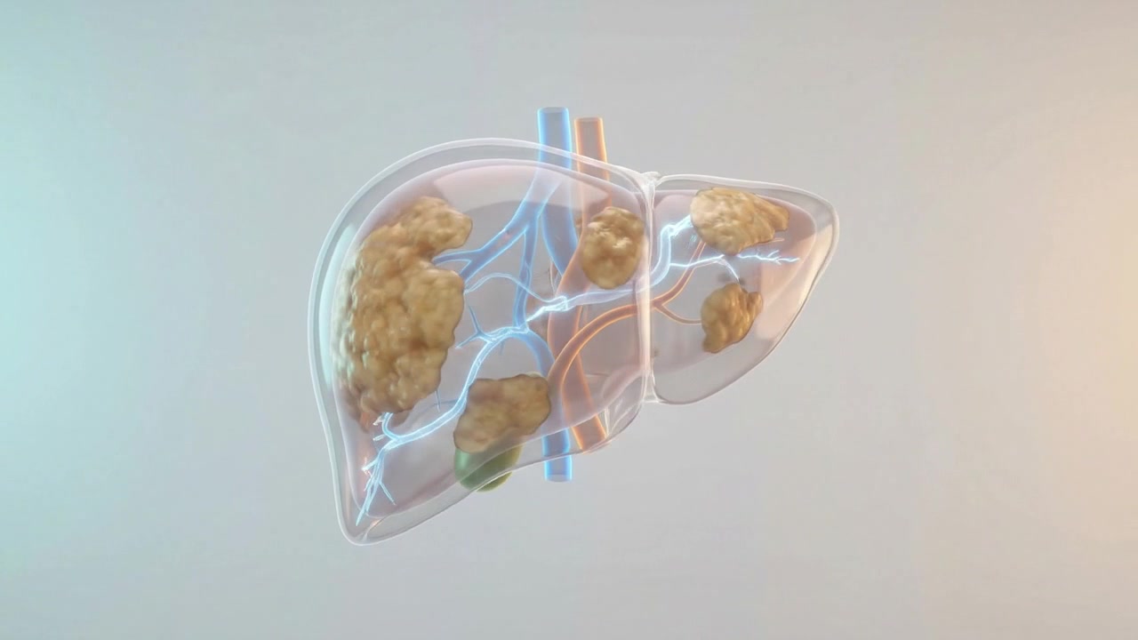 Transparent human liver model with branching vessels displayed on white background