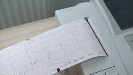 the electrocardiogram device prints a sheet with the results of the analysis.