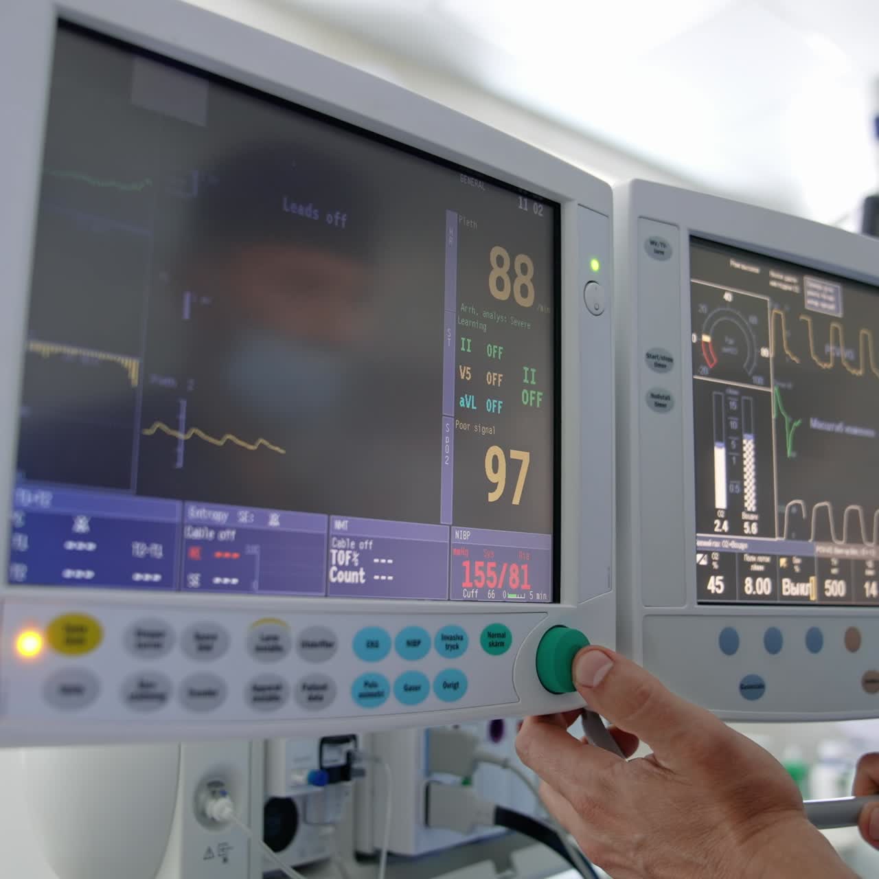 Health monitors in intensive care unit. Screen of monitors showing vital signs of a patient during the operation in hospital. Health care concept