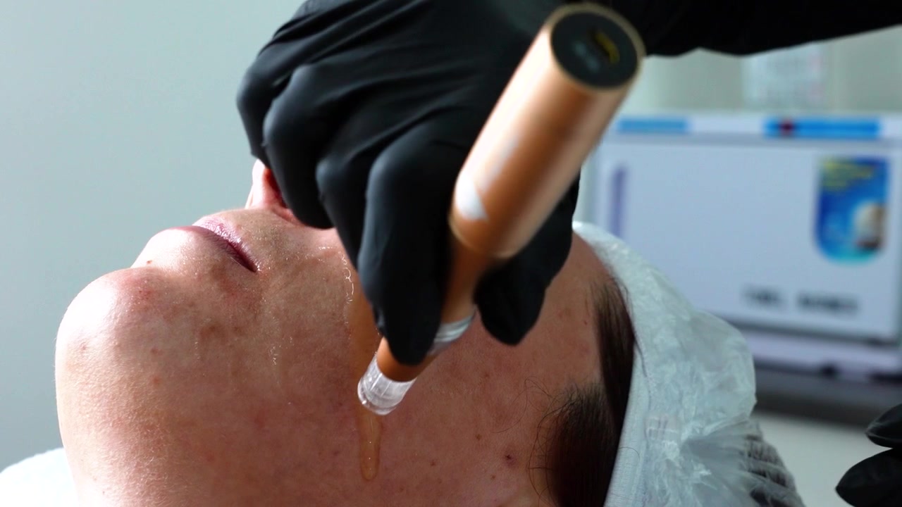 Påfører serum på kundens ansigt under hudplejebehandling