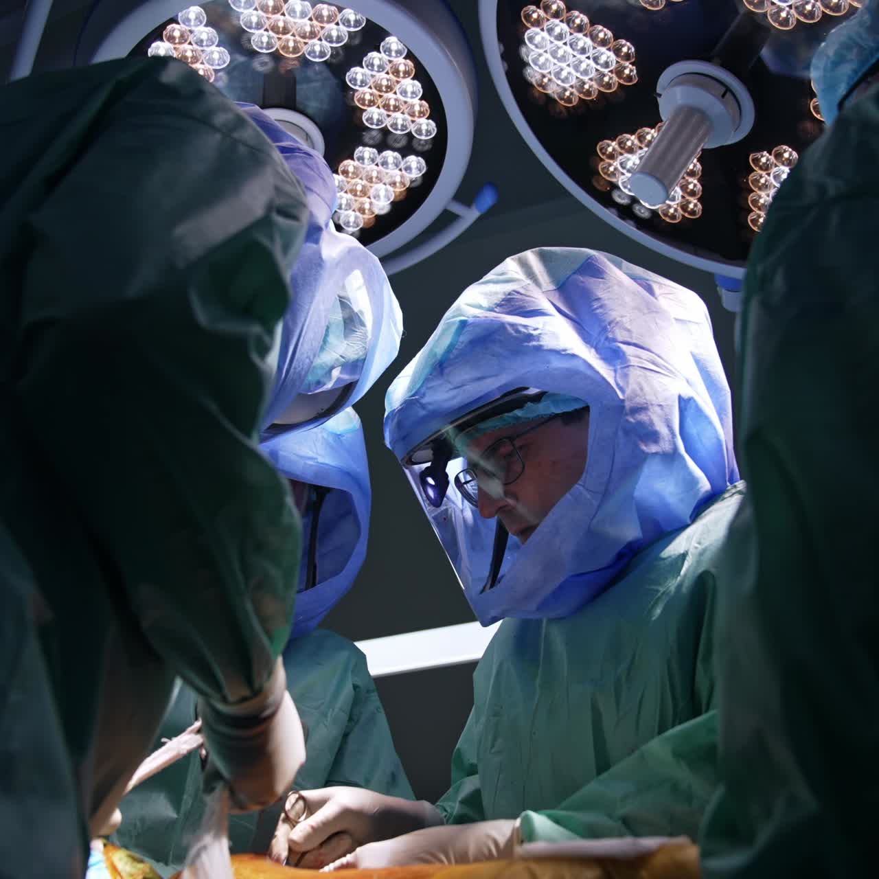 Medical group perform arthroscopic operation under the lamps in surgery room. Doctors work in protective suits. Low angle view