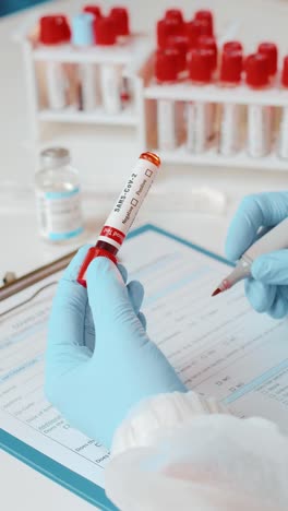 testing samples in a medical setting with a doctor wearing gloves