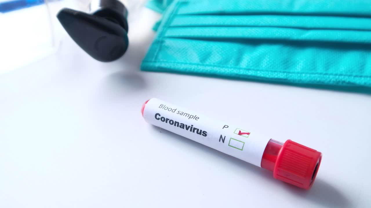 Test del campione di sangue per Coronavirus con DPI