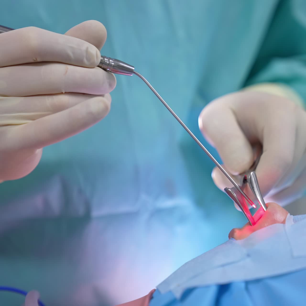 Surgeon's hands holding special medical tools during nasal operation. Doctor perform a modern surgery on a nose. Close-up