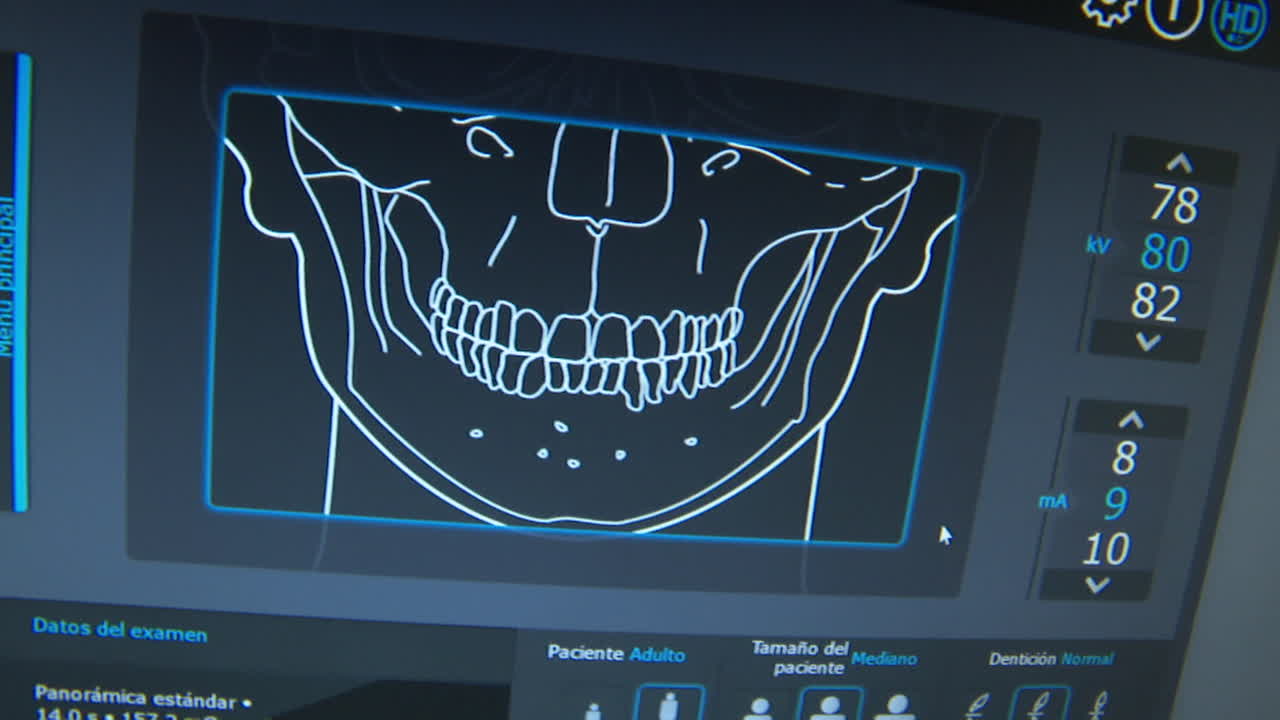 Dental Panoramic X-Ray Image