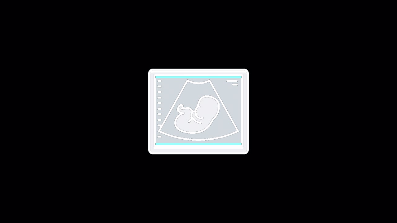 Animated Ultrasound Scan Showing a Developing Fetus