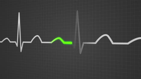 animation of a schematic diagram of normal sinus rhythm for a human heart seen on electrocardiograph screen. blue highlight on a bright background. perfect for any medical-related purposes.