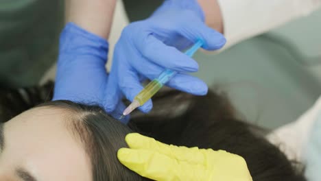 tratamiento con plasma del cuero cabelludo. procedimiento de mesoterapia capilar en la clínica de cosmetología moderna