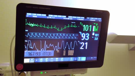 close up cardiogram monitor in hospital room shows patient heart rate and condition