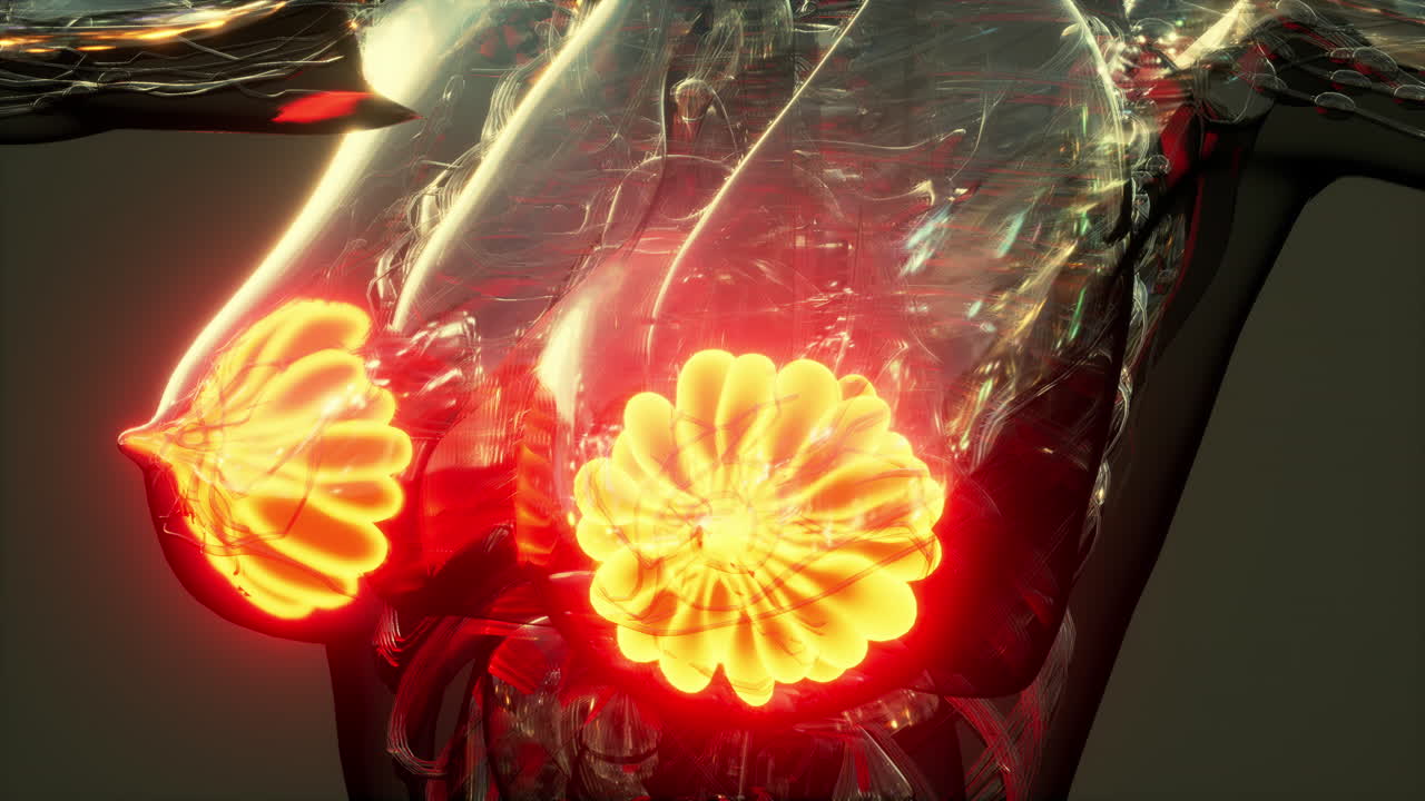 염증의 초점인 암을 가진 여성 유방