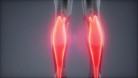 gastrocnemius- visible muscle anatomy map