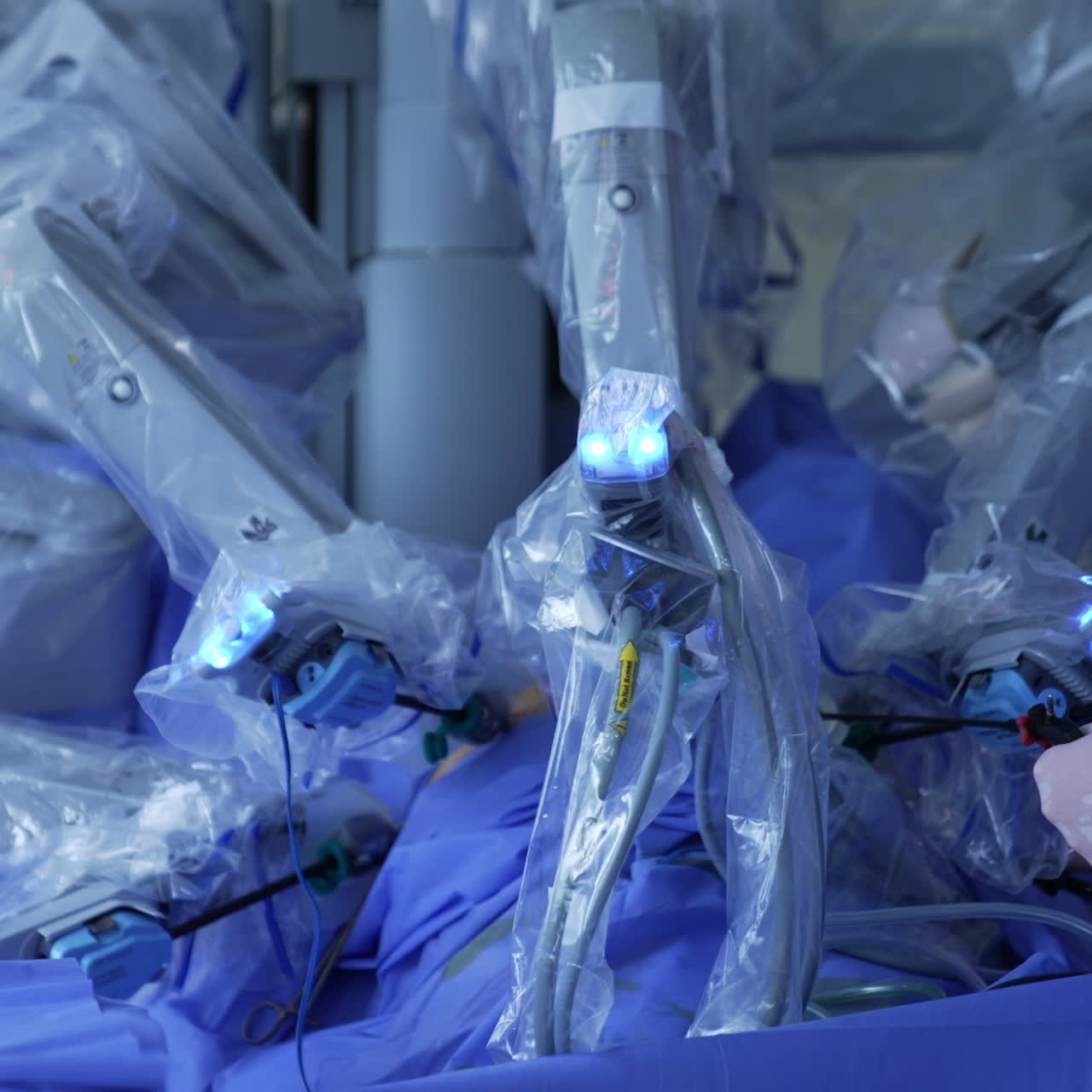 Da Vinci robotic surgeon performing surgery. Unrecognized doctor in latex gloves holds the long instrument in patient's body