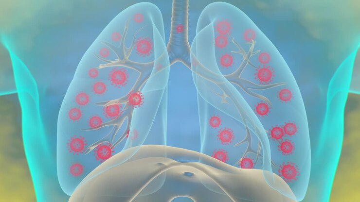 Coronavirus disease Virus in Respiratory system