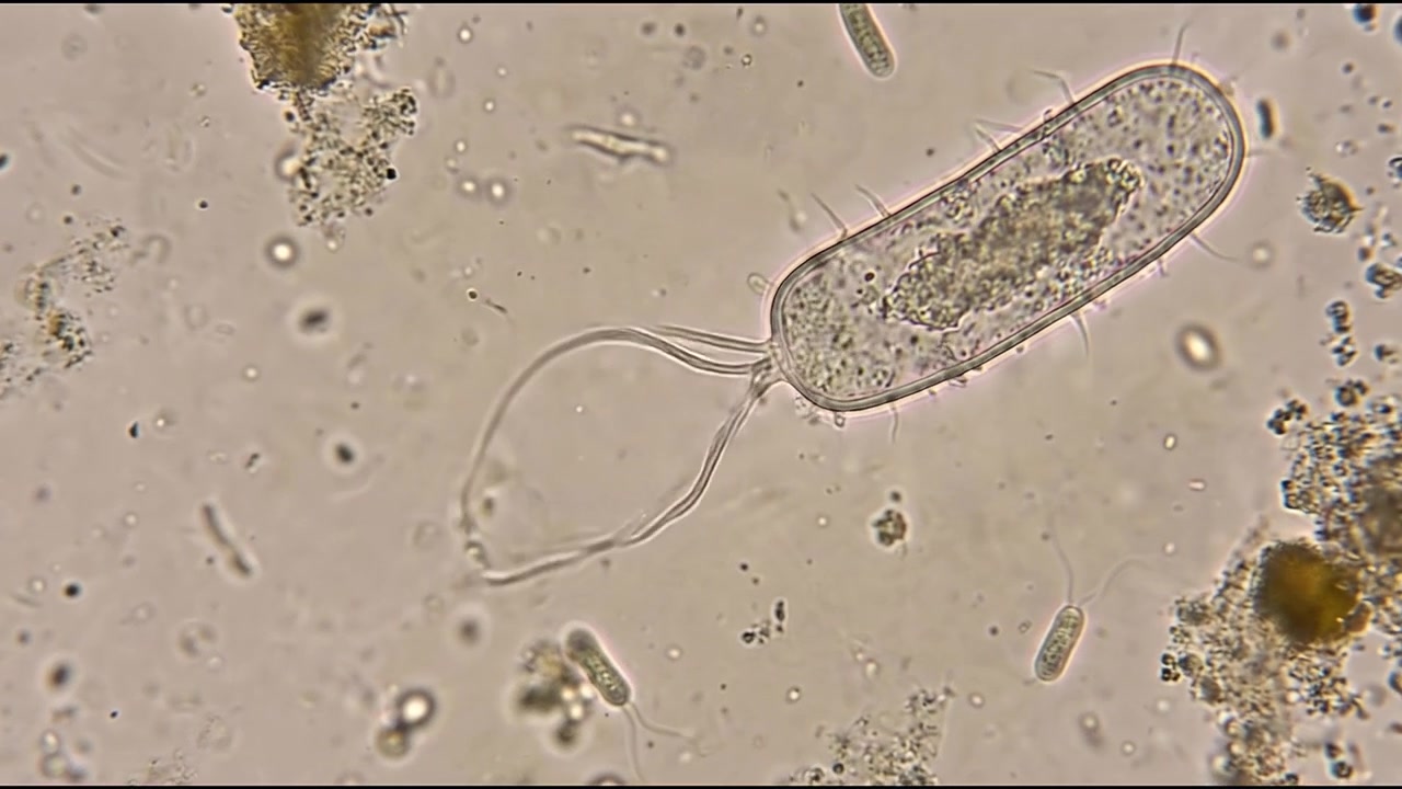 Vue microscopique d'un protozoaire cilié nageant