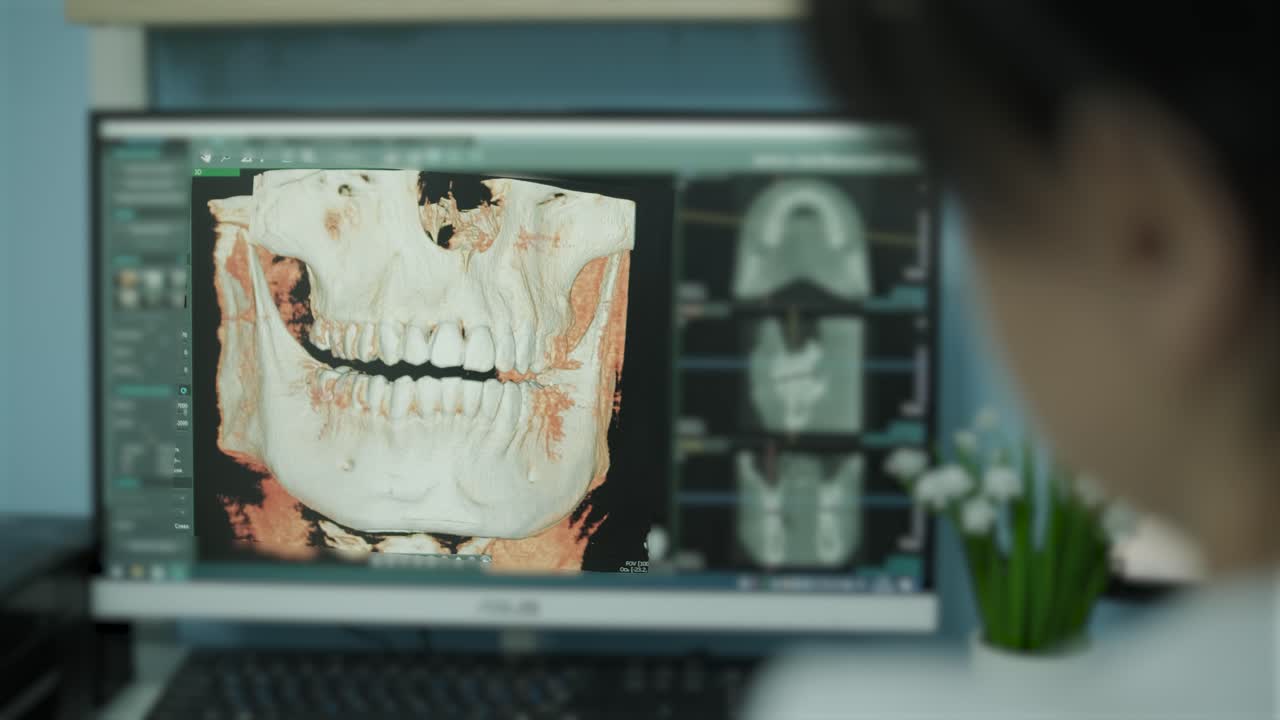 médico analizando el escáner dental 3d en la pantalla de la computadora