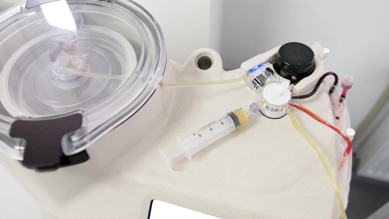 Macchina che separa il plasma dal sangue. Primo piano. Attrezzatura moderna che prepara concentrato di PRP.