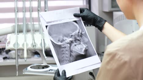 dental x-ray of head and jaw