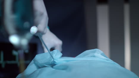 Chirurg-Patient-Atmet-Sauerstoffmaske-Während-Der-Operation.-Chirurgen-Operieren