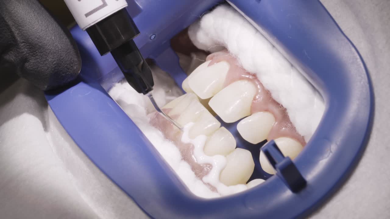 Professional Teeth Whitening Procedure