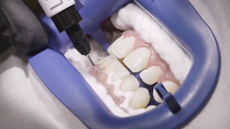 professional teeth whitening procedure