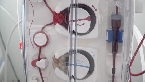 Close-up-of-moving-parts-of-a-dialysis-machine-with-blood-pumping-through-it