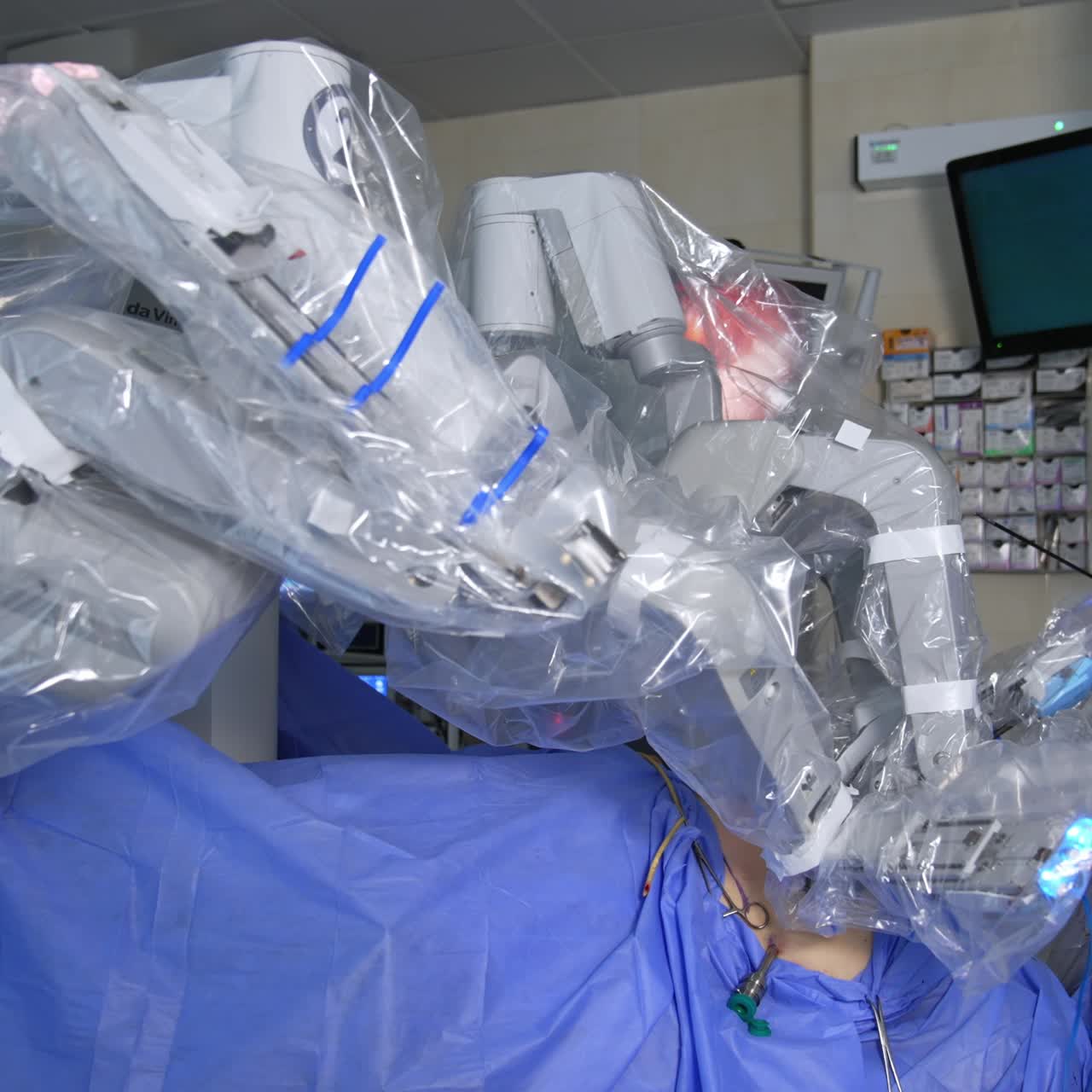 Futuristic robot Da Vinci operating the patient in modern hospital. Surgeon with a tool in hands watches the procedure at monitor