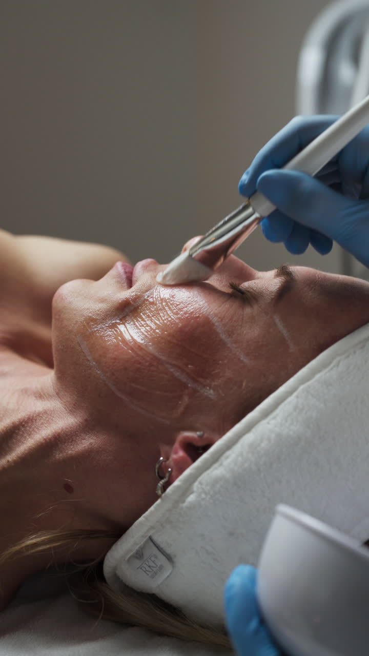 The Esthetician is Applying a Clear Treatment Gel to the Marked Areas of the Client's Face Using a Brush - Close Up