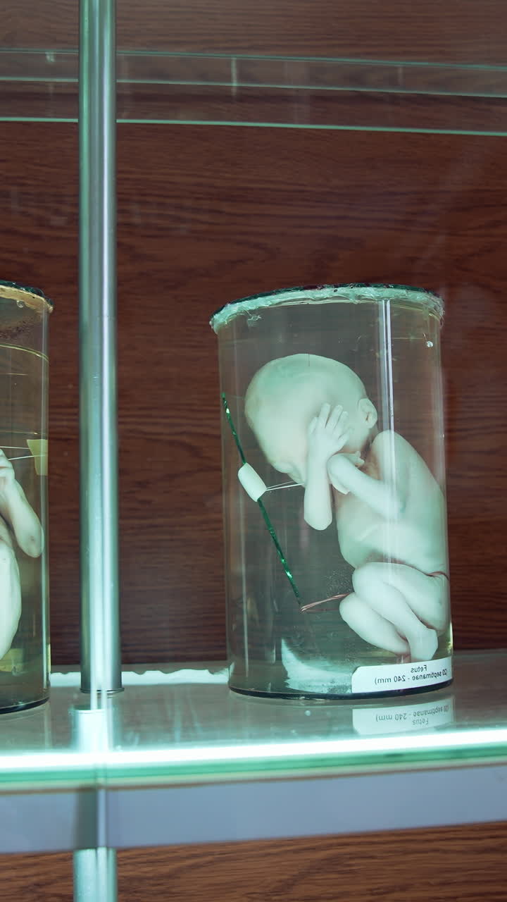 Fetus in formalin solution in museum. Human organs in jars with formalin in anatomical museum. Vertical video