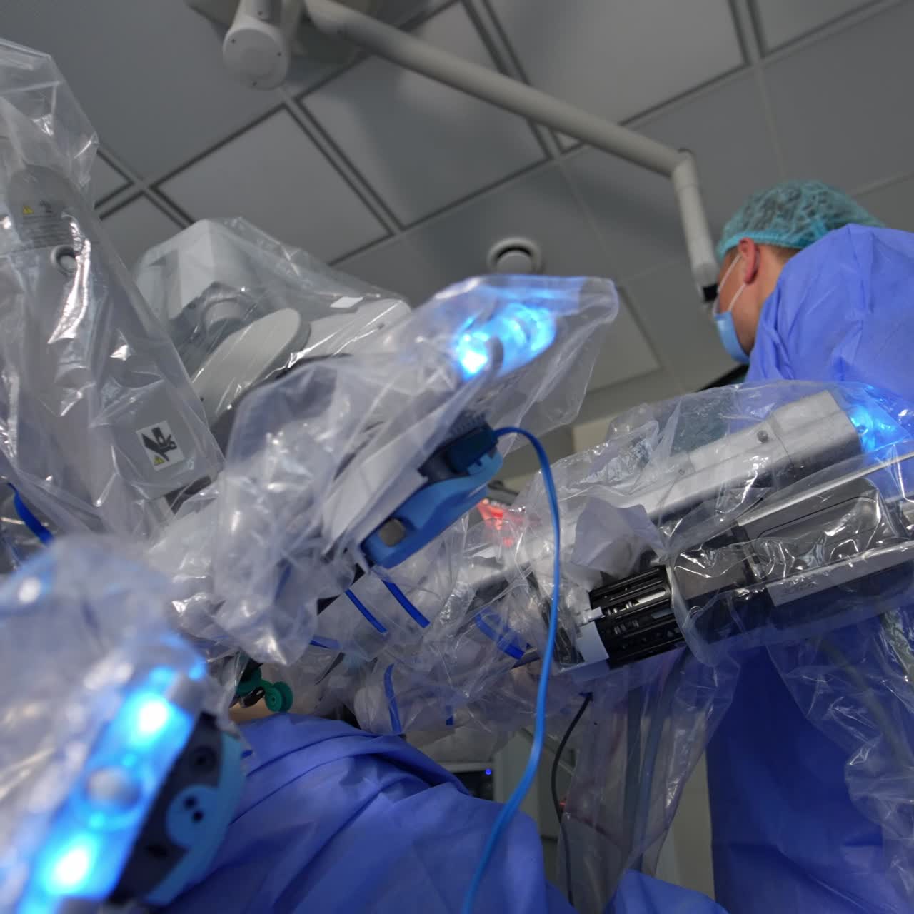 First surgical assistant stands in the operative field of Da Vinci system. Robotic arm coated with plastic move slowly performing laparoscopy. Low angle view
