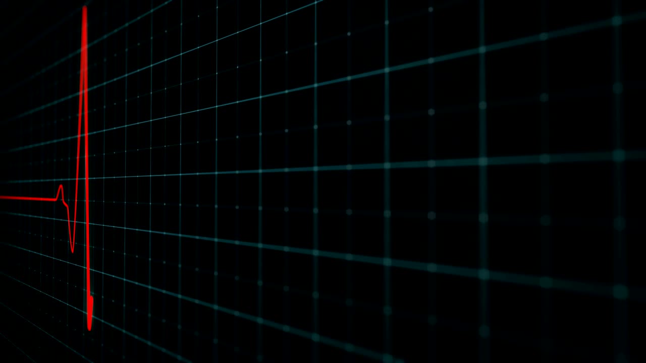 secuencia de impulsos cardíacos en la pantalla médica