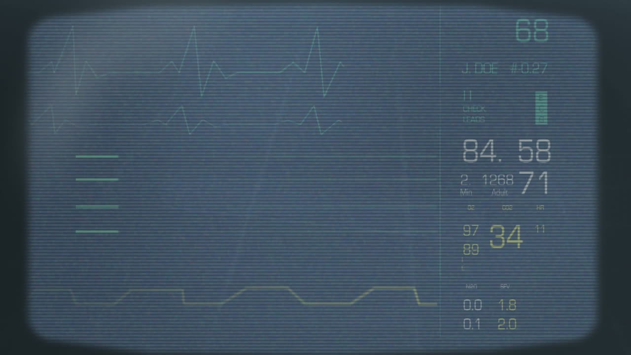 데이터 차트 와 다이어그램 이 오래된 tv 스크린 에서 나타나고 사라지고 있다
