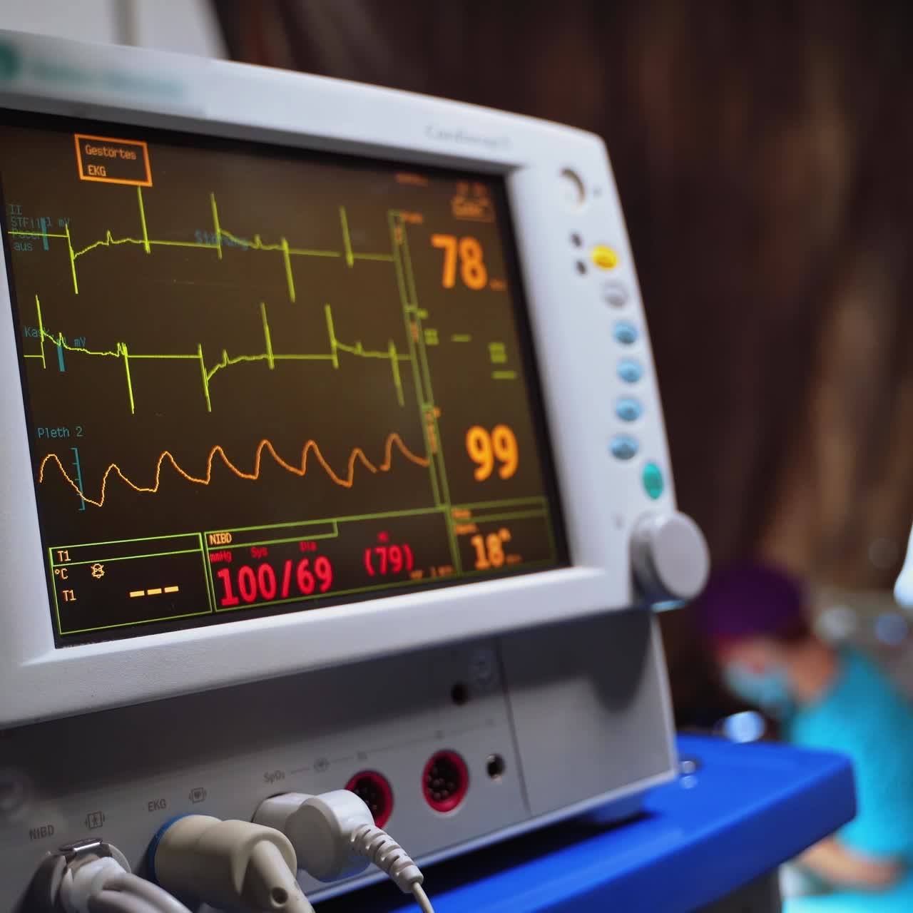 Heart rate monitor in surgical room. Vital signs of a patient on the monitor in a hospital. Patient heartbeat on the screen during operation.