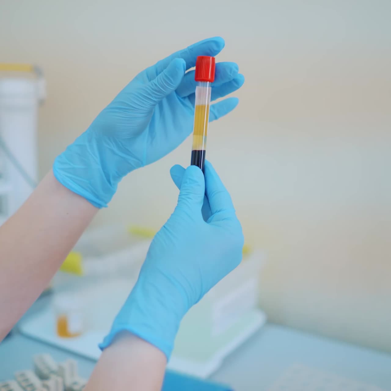 Hand holding a tube test