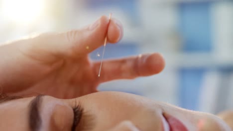 mujer que recibe tratamiento de acupuntura en una clínica