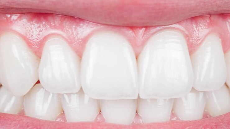 Close-up of healthy pink gums and bright white teeth slowly panning across a clean smile