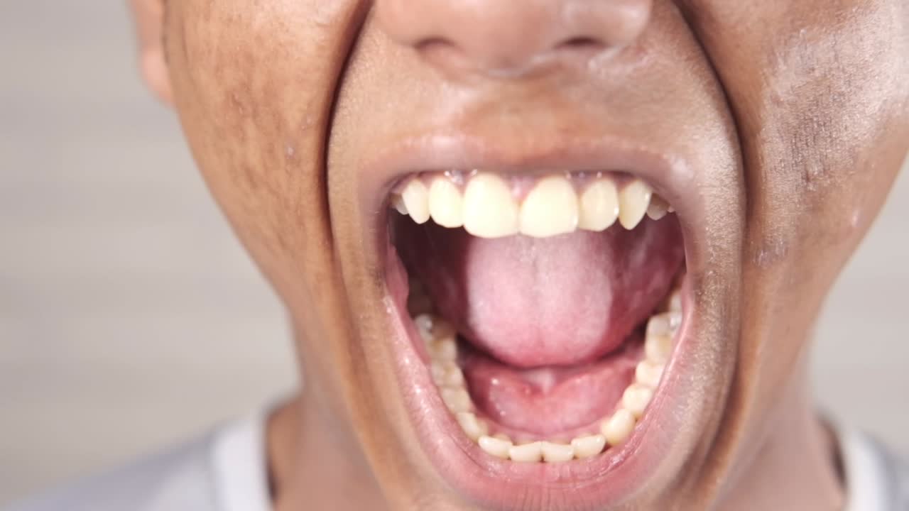 입이 열린 사람