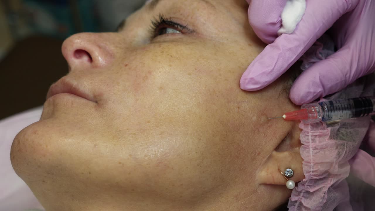 Cosmetic Facial Injection for Anti-Aging