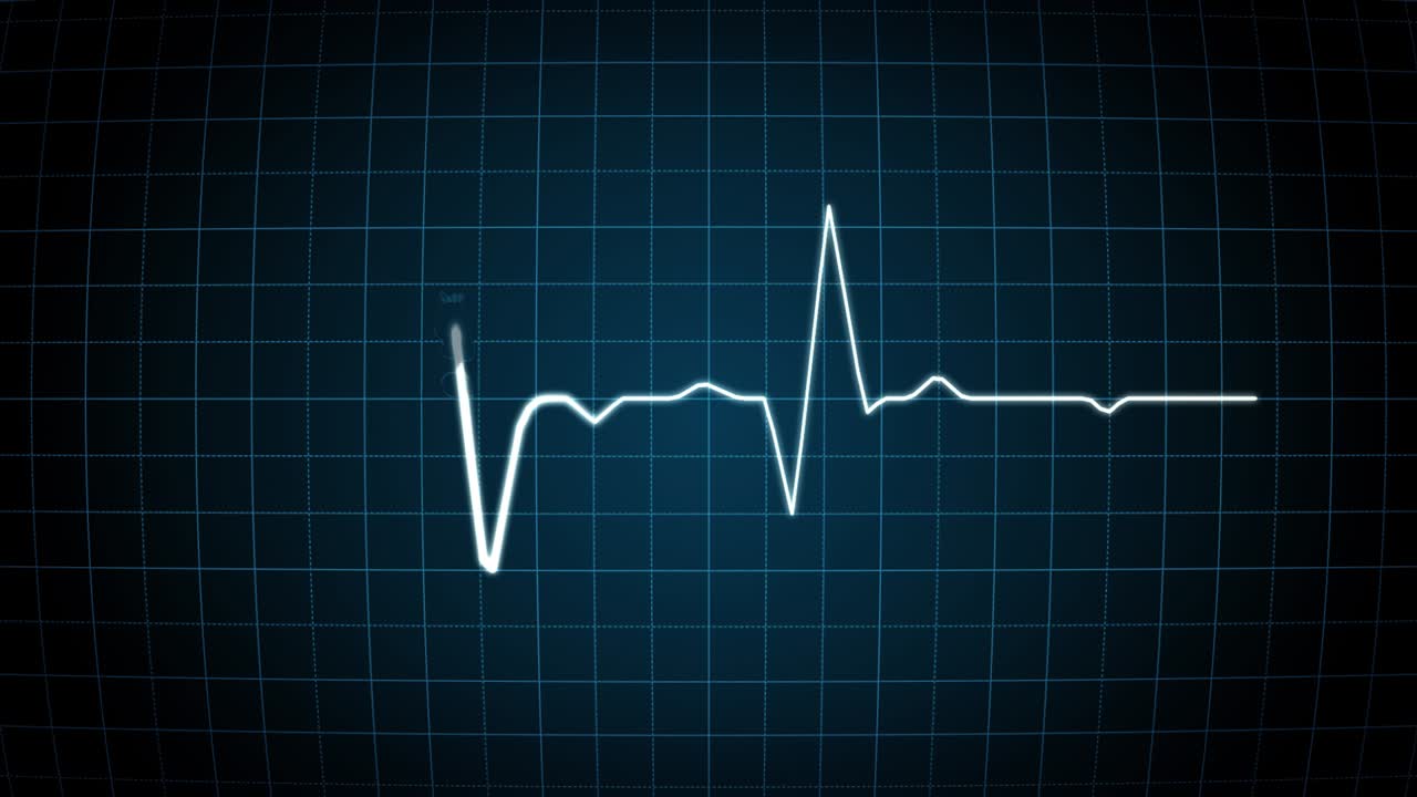 slow animation heartbeat on monitor. Animantion of a heartline, lifeline on a dark patterned background. infographic line. statistics. moving heart rate line