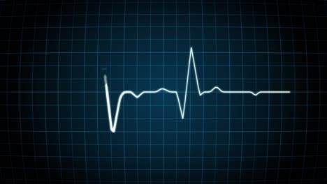 slow animation heartbeat on monitor. animantion of a heartline, lifeline on a dark patterned background. infographic line. statistics. moving heart rate line