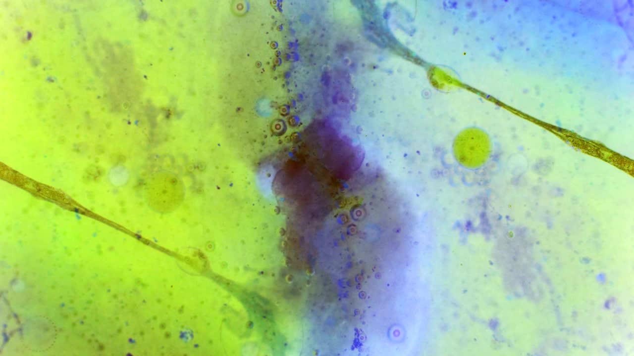 el rizado de las pinturas