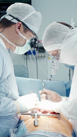 enfermera de lavado da herramientas al cirujano. equipo quirúrgico experimentado realiza cirugía en el corazón del paciente que trata la enfermedad de la arteria coronaria en la sala de operaciones