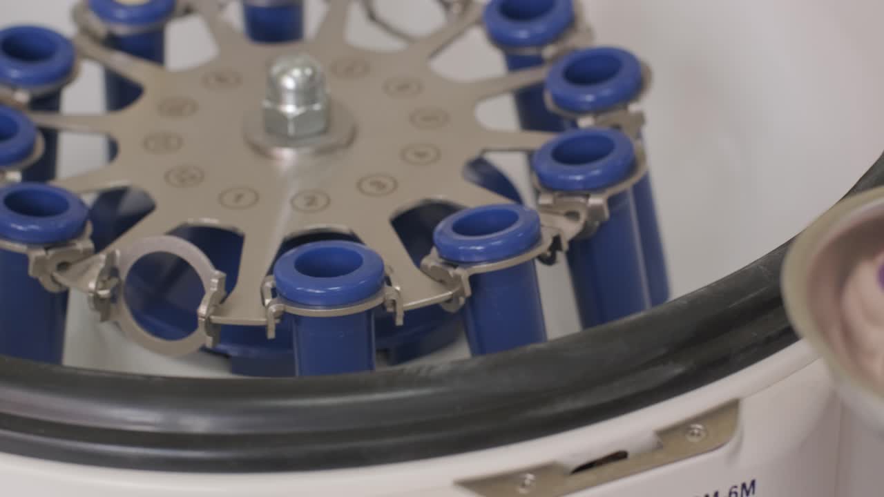 preparación de plasma rico en plaquetas. tubo con sangre en las manos. centrifugadora.