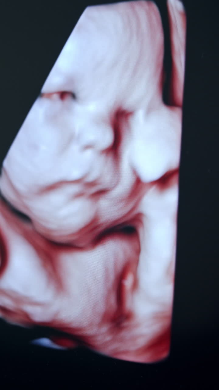 Cute prenatal image of unborn baby holding his hand at face. Intrauterine picture of a child on the ultrasonic machine monitor.