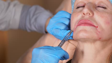 procedimiento de inyección facial