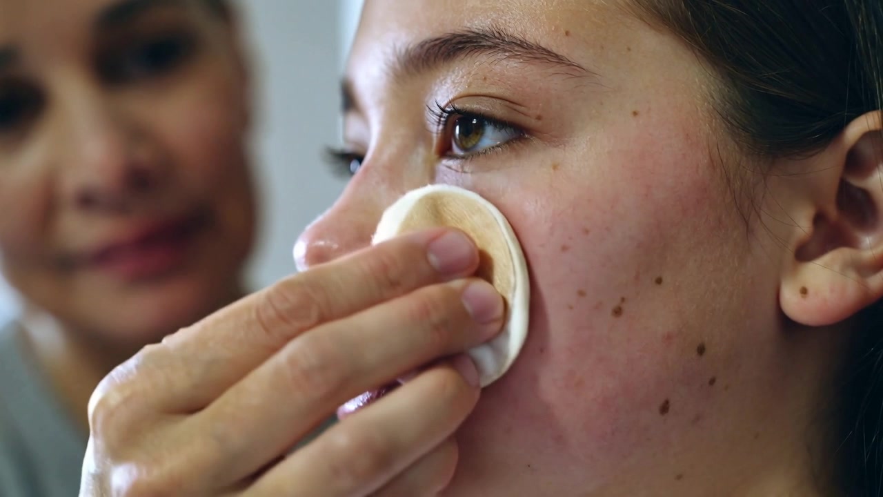 Placing cotton pad, mother gently wiping teenage girl's right cheek at home, removing product