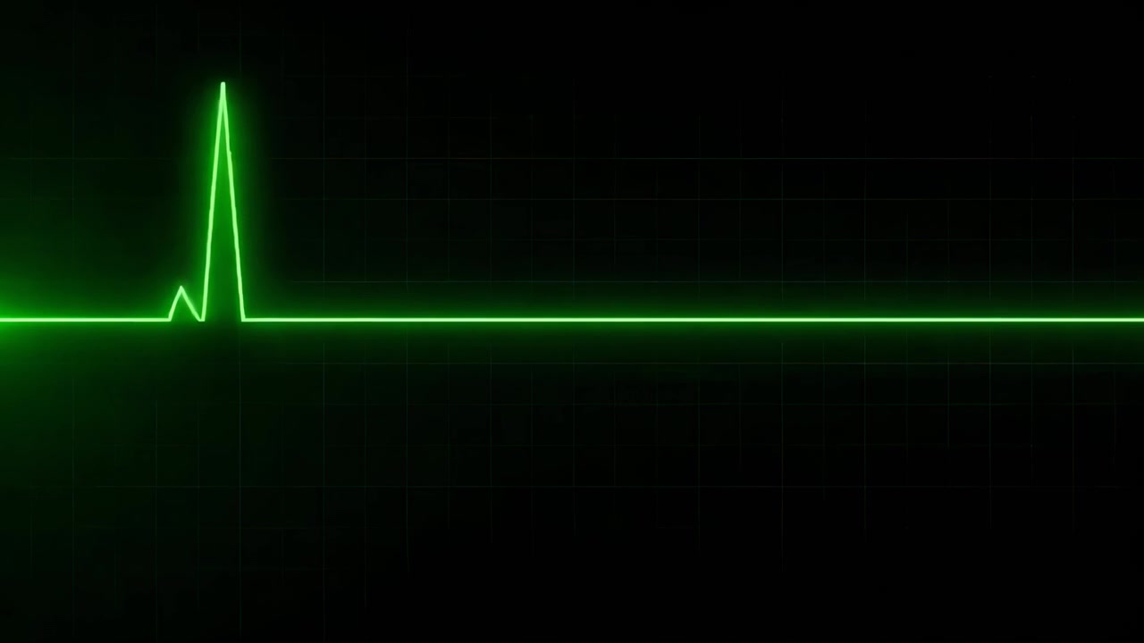 Grønn EKG-linje fra hjerteovervåker på svart bakgrunn