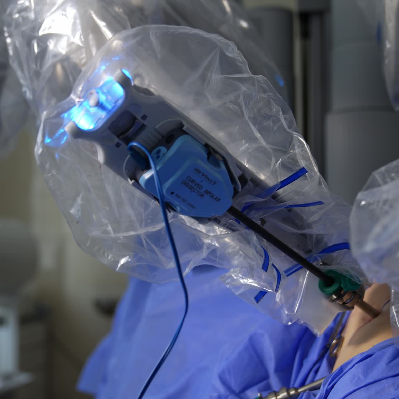 Manipulator arm moving in the abdomen of a patient. Minimal invasive surgery conducted by robot in modern hospital
