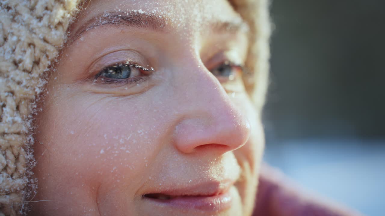 Woman's Face Covered in Frost