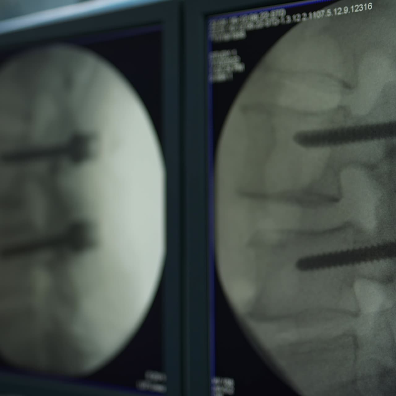 Professional medical equipment. Surgery devices close up view