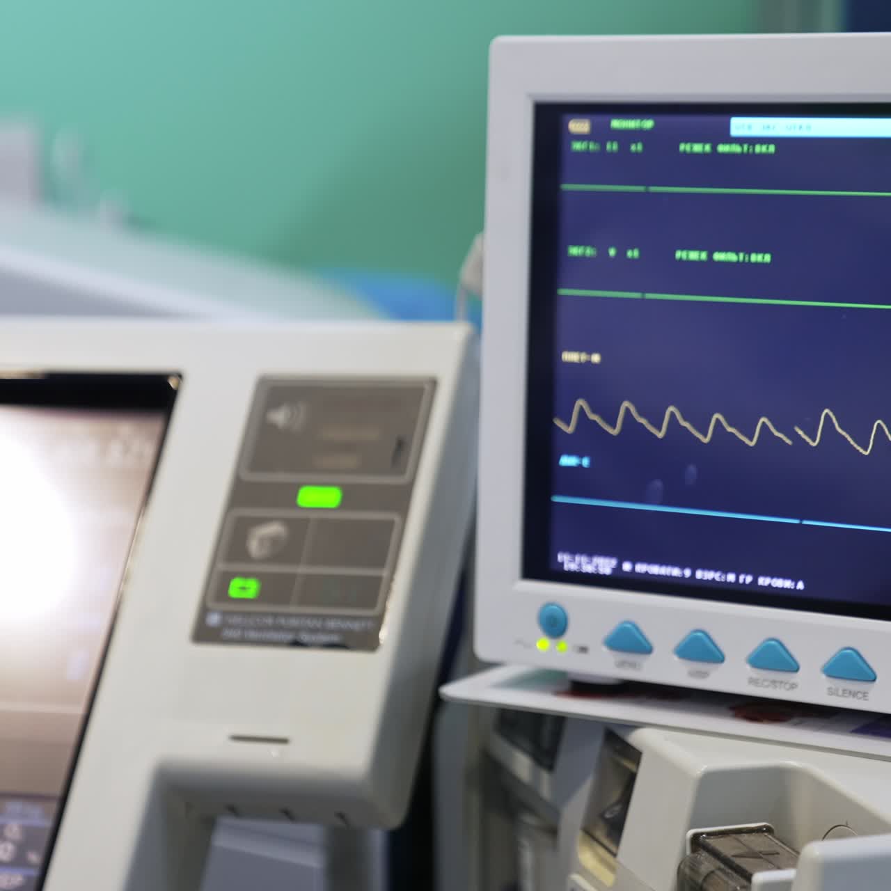 Screen with life signs of operated patient. Modern equipment working during surgery. Close up